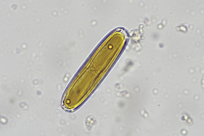 diatom